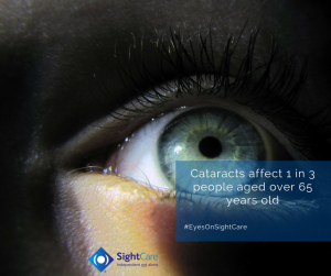 cataracts